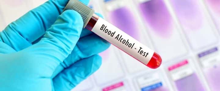 California Criminal Defense Attorney Defines DUI Breath and Blood Tests